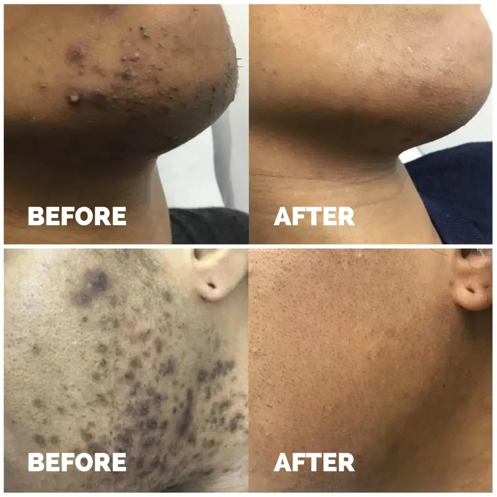 Smoothing Solution